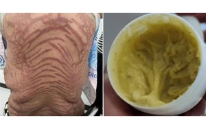 Cô gái giảm cân kỷ lục nhờ ăn cả trăm con chuột - Ảnh 8.