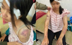 Bắt tạm giam cựu Phó Cục trưởng Cục An toàn thực phẩm cùng 13 đồng phạm- Ảnh 3.