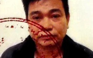 Giải cứu nam thanh niên “chứng minh tài chính” để đi Mỹ bằng cách phối hợp tạo ra vụ bắt cóc giả - Ảnh 1.