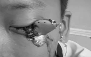 Người đàn ông liên tục đau bụng, bác sĩ sốc nặng khi phát hiện "bí mật" đáng sợ- Ảnh 3.