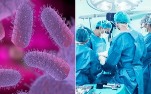 Nhiễm trùng nấm khiến 1 người nguy kịch và 18 ca mắc bệnh - Ảnh 3.