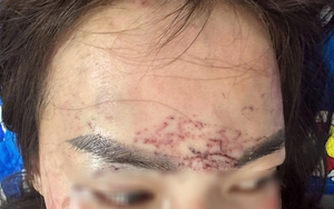 Khởi tố vụ người phụ nữ bị cắt tóc, xăm trán, đánh đập gây thương tích để điều tra