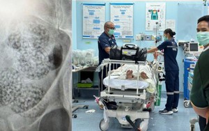 Người đàn ông 43 tuổi bất ngờ co giật tại sân bay, đi cấp cứu bác sĩ phát hiện 