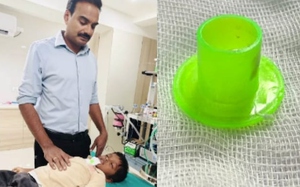 Bé trai đau họng đi khám, bác sĩ sốc nặng khi lấy ra thứ bên trong