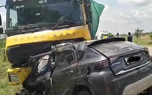 Con gái kêu đau đầu dữ dội, mẹ đưa đi chụp CT thì sốc nặng- Ảnh 2.