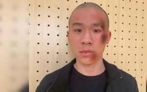 Nữ t&agrave;i xế đạp nhầm ch&acirc;n ga t&ocirc;ng li&ecirc;n ho&agrave;n 6 xe m&aacute;y tr&ecirc;n phố - Ảnh 2.