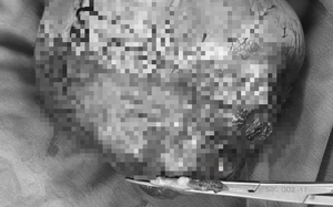 Bộ Y tế y&ecirc;u cầu kiểm tra khẩn bếp ăn nh&agrave; h&agrave;ng tiệc cưới sau phản &aacute;nh mất vệ sinh - Ảnh 3.