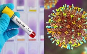 Bộ Y tế thu hồi, ti&ecirc;u hủy 6 sản phẩm mỹ phẩm - Ảnh 3.