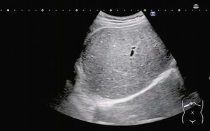 Muốn bảo vệ gan, đừng bỏ qua 5 loại đồ uống quen thuộc n&agrave;y, nhất c&aacute;i số 1 kh&ocirc;ng tốn tiền - Ảnh 2.