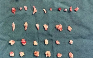 H&agrave; Nội tăng cường gi&aacute;m s&aacute;t bệnh dại - Ảnh 4.