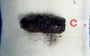 Nam sinh lớp 8 co giật sau khi thử &ldquo;ngủ 6 gi&acirc;y&rdquo; tr&ecirc;n TikTok: B&aacute;o động tr&agrave;o lưu nguy hiểm chết người - Ảnh 5.