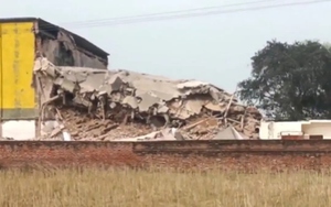 Người phụ nữ mắc căn bệnh hiếm gặp khiến ch&acirc;n sưng to như "ch&acirc;n voi" - Ảnh 2.