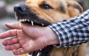 Cụ &ocirc;ng 83 tuổi bị ch&oacute; b&eacute;c gi&ecirc; nu&ocirc;i trong nh&agrave; cắn tử vong thương t&acirc;m - Ảnh 3.