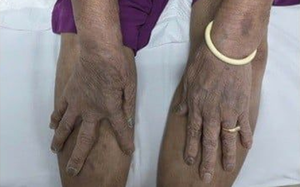 Cấp cứu 3 người bị co giật, h&ocirc;n m&ecirc; nghi ngộ độc sau bữa ăn trưa- Ảnh 2.