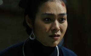 "Mỹ nh&acirc;n c&oacute; v&ograve;ng eo ảo nhất Vbiz" bầm dập trầy trụa g&acirc;y x&ocirc;n xao - Ảnh 10.