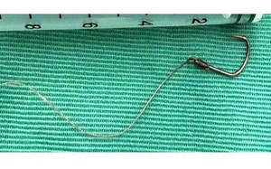 Tr&egrave;o cửa sổ ng&oacute;ng mẹ trở về, b&eacute; trai 4 tuổi tho&aacute;t chết kỳ diệu sau c&uacute; rơi từ tầng 11- Ảnh 2.