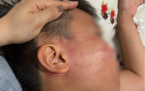 Kỳ thi t&uacute; t&agrave;i nổi tiếng nước Ph&aacute;p đối mặt th&aacute;ch thức chưa từng c&oacute; - Ảnh 2.