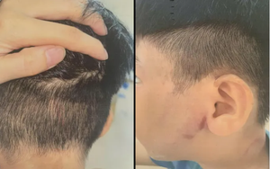 C&aacute;nh cửa đại học mở th&ecirc;m: H&agrave;ng loạt trường &ldquo;hot&rdquo; x&eacute;t tuyển bổ sung, chỉ ti&ecirc;u l&ecirc;n tới 2.000 - Ảnh 2.