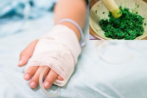 17 năm sống chung khối u ngón tay, bệnh nhân bất ngờ mắc dị dạng mạch máu - Ảnh 4.
