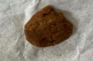 B&eacute; trai 5 tuổi "&ocirc;m" ổ kh&oacute;a nhập viện cấp cứu, b&aacute;c sĩ ph&aacute;t cảnh b&aacute;o khẩn - Ảnh 3.