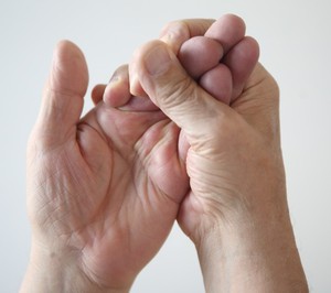 Cứ nghĩ tê tay do mỏi, ai ngờ mắc bệnh nguy hiểm- Ảnh 2.