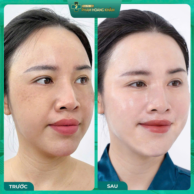 Bí quyết làn da khỏe đẹp chuẩn y khoa từ Phòng khám Da liễu 42 Liễu Giai - Ảnh 3.