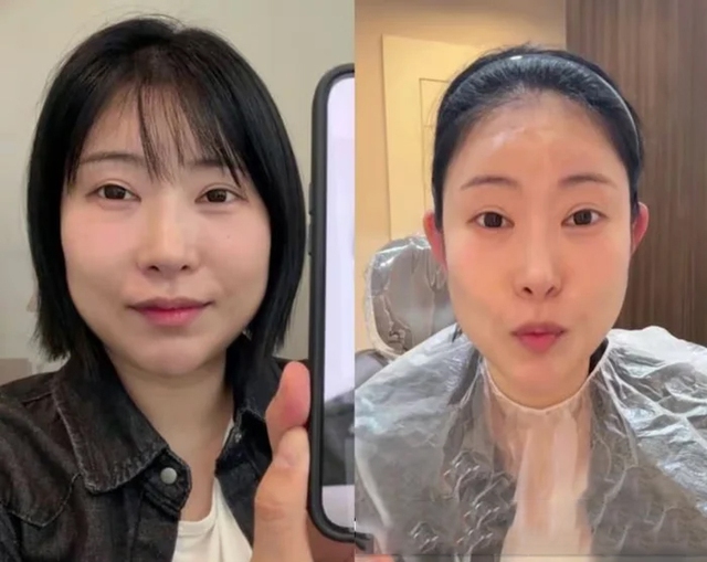 Sao nữ chi gần 3 tỷ đồng để phẫu thuật thẩm mỹ và cái kết bất ngờ - Ảnh 1.