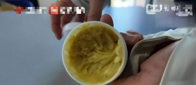 Người phụ nữ 40 tuổi, da biến dạng kinh hoàng vì sai lầm nhiều người mắc- Ảnh 1. Người phụ nữ 40 tuổi, da biến dạng kinh hoàng vì sai lầm nhiều người mắc- Ảnh 1.