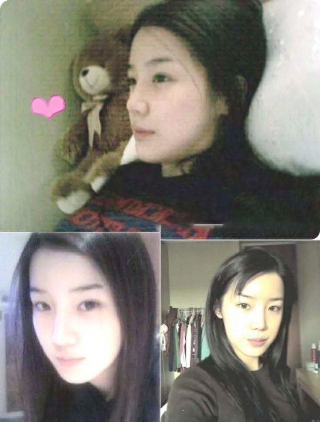 Nữ ca sĩ hàng đầu showbiz gây sốc với gương mặt biến dạng- Ảnh 1. Nữ ca sĩ hàng đầu showbiz gây sốc với gương mặt biến dạng- Ảnh 1.