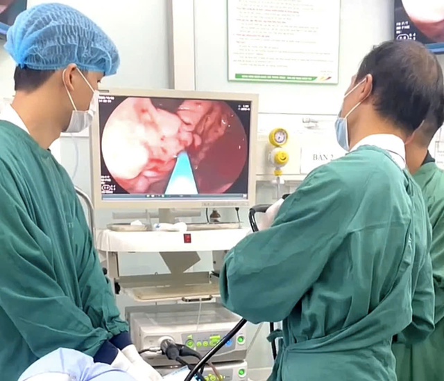 Chủ quan với cơn đau bụng, người đàn ông suýt đánh đổi bằng mạng sống- Ảnh 2. Chủ quan với cơn đau bụng, người đàn ông suýt đánh đổi bằng mạng sống- Ảnh 2.