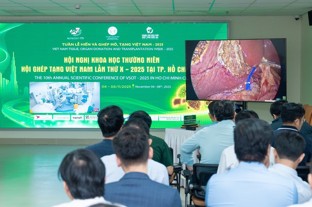 Vinmec trình diễn kỹ thuật ghép gan sống phức tạp tại Hội nghị Ghép tạng Việt Nam 2025 - Ảnh 2.