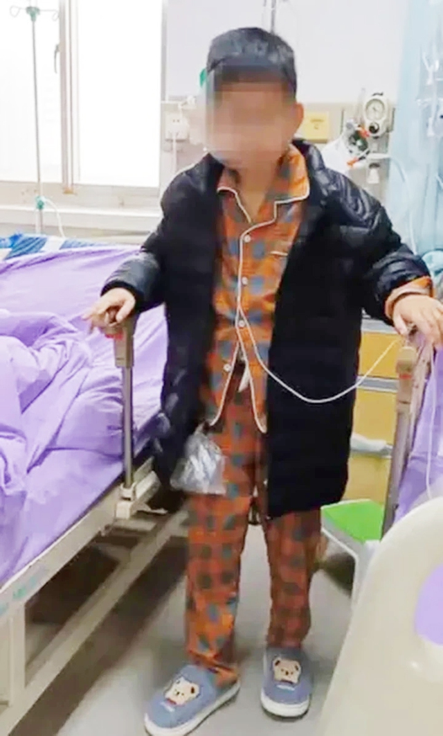 Cậu bé 12 tuổi bị cắt bỏ gần như hoàn toàn hệ tiêu hóa, sống nhờ truyền dịch - Ảnh 1.