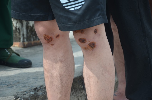 Cạm bẫy nơi xứ người: Nước mắt nạn nhân ngày được trở về - Ảnh 2.