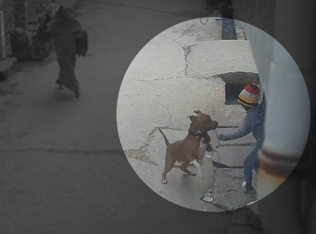 Đang chơi trên phố, cậu bé bị chó Pitbull tấn công- Ảnh 1.