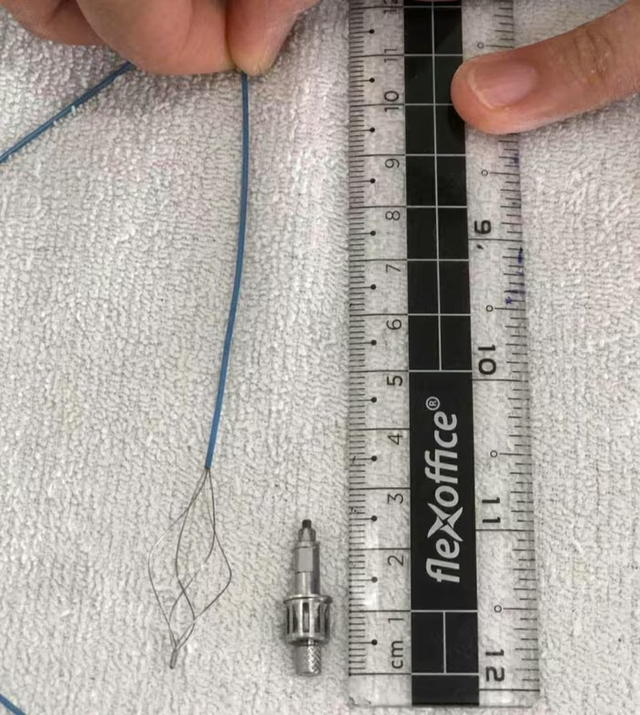 Đi khám răng về người đàn ông ho dữ dội, bác sĩ phát hiện bí mật "đáng sợ" bên trong - Ảnh 2.