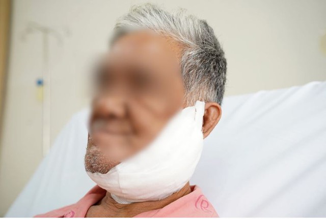 Lý do khiến người đàn ông 6 năm không dám soi gương - Ảnh 1.