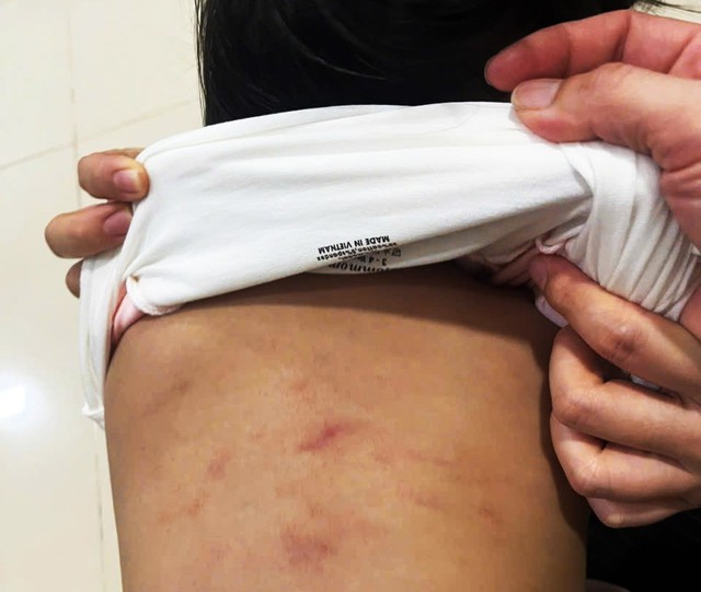 Bản tin 7/11: L&agrave;m r&otilde; vụ ch&aacute;u b&eacute; 2 tuổi nghi bị bạo h&agrave;nh tại lớp tr&ocirc;ng trẻ- Ảnh 1.