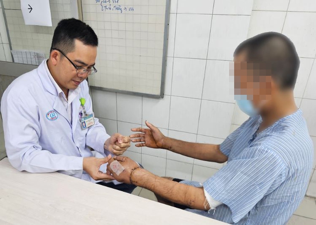 Ẩu đả với hàng xóm, người đàn ông bị chém đứt lìa 2 bàn tay được các bác sĩ nối thành công - Ảnh 2.