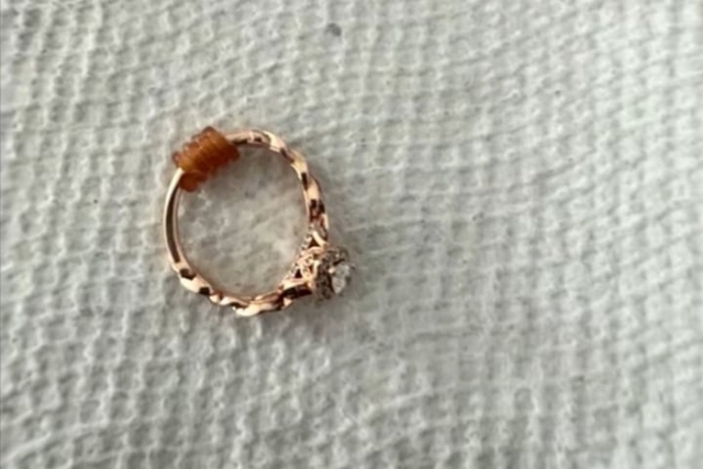 Chụp X-quang, bác sĩ phát hiện ra "bí mật" trong bụng chú chó - Ảnh 2.