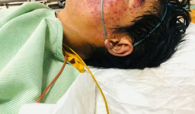 Người đàn ông 32 tuổi tiên lượng tử vong cao vì ăn món "vạn người mê"- Ảnh 1. Người đàn ông 32 tuổi tiên lượng tử vong cao vì ăn món "vạn người mê"- Ảnh 1.