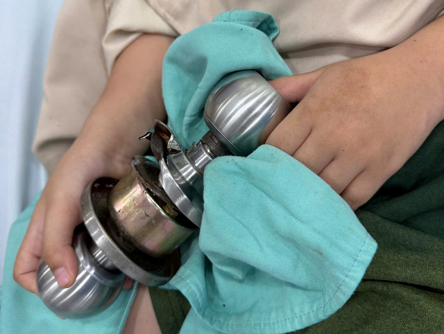 B&eacute; trai 5 tuổi "&ocirc;m" ổ kh&oacute;a nhập viện cấp cứu, b&aacute;c sĩ ph&aacute;t cảnh b&aacute;o khẩn - Ảnh 1.