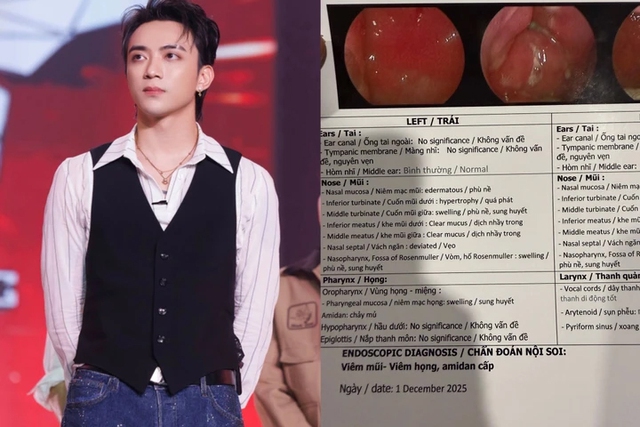Ca sĩ Soobin gặp vấn đề sức khoẻ khiến người fan lo lắng - Ảnh 1.
