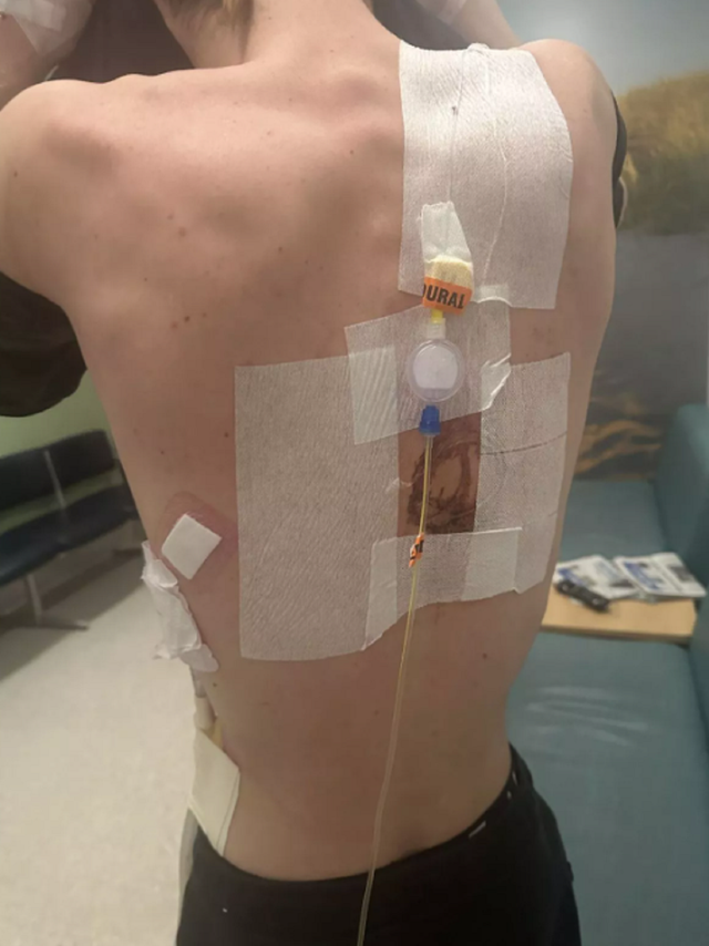 Nam thanh niên 17 tuổi phải cắt một phần phổi vì hay sử dụng thứ giới trẻ "mê tít" - Ảnh 1.