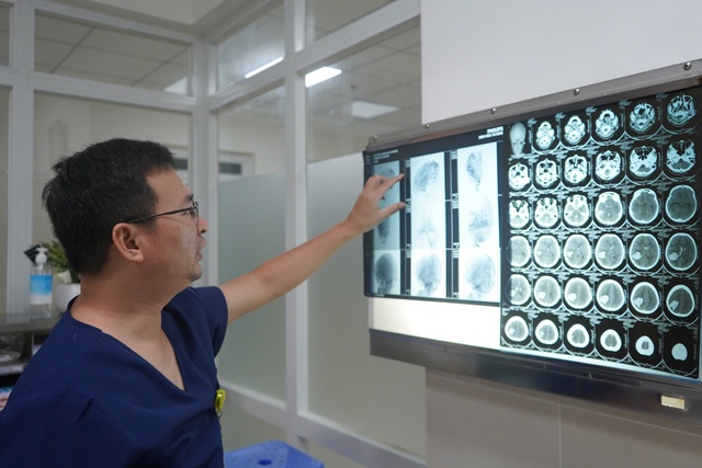Hai lần phẫu thuật, bác sĩ giành lại sự sống cho bệnh nhi 13 tuổi bị vỡ mạch máu não- Ảnh 2. Hai lần phẫu thuật, bác sĩ giành lại sự sống cho bệnh nhi 13 tuổi bị vỡ mạch máu não- Ảnh 2.
