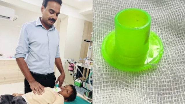 Bé trai đau họng đi khám, bác sĩ sốc nặng khi lấy ra thứ bên trong- Ảnh 1.