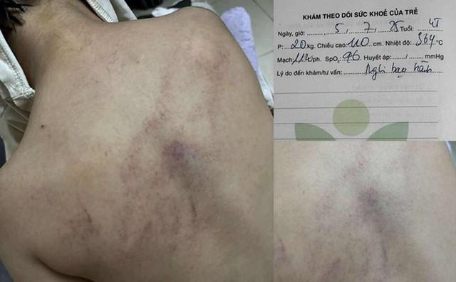 Cục Bà mẹ và Trẻ em phản hồi vụ cô giáo dốc ngược đầu trẻ, ném xuống giường - Ảnh 2.