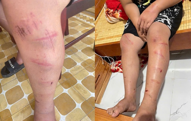 Xác minh thông tin nam sinh ở Huế bị người đàn ông xích chân rồi hành hung- Ảnh 1. Xác minh thông tin nam sinh ở Huế bị người đàn ông xích chân rồi hành hung- Ảnh 1.
