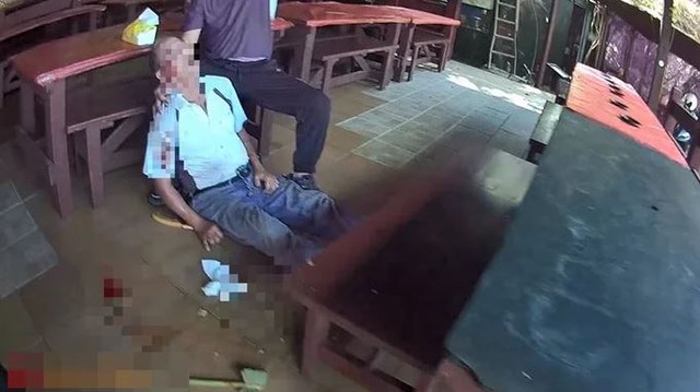 Đang nhổ cỏ, người đàn ông 67 tuổi gặp sự cố đáng sợ - Ảnh 1.