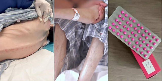 Uống 200 viên thuốc mỗi ngày để giảm cân, người phụ nữ nhập viện- Ảnh 1. Uống 200 viên thuốc mỗi ngày để giảm cân, người phụ nữ nhập viện- Ảnh 1.