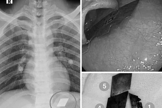 Khám cho nam thanh niên 26 tuổi, bác sĩ phát hiện thứ không ai ngờ - Ảnh 1.